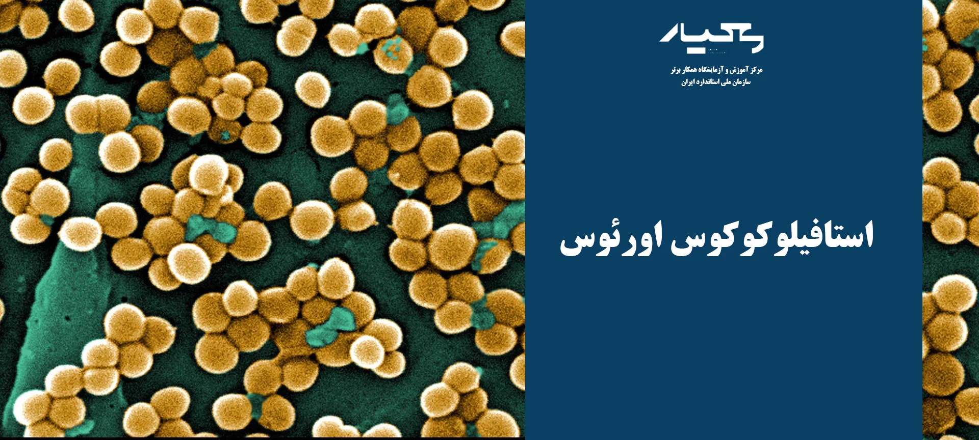 استافیلوکوکوس اورئوس