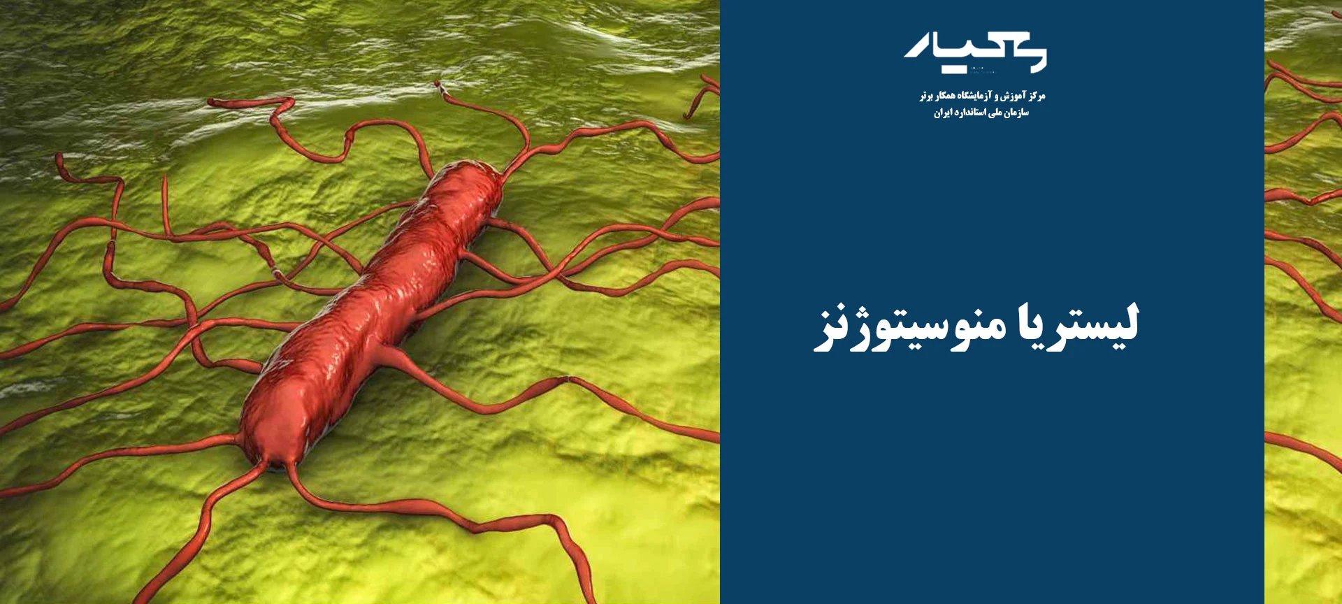 باکتری لیستریا منوسیتوژنز